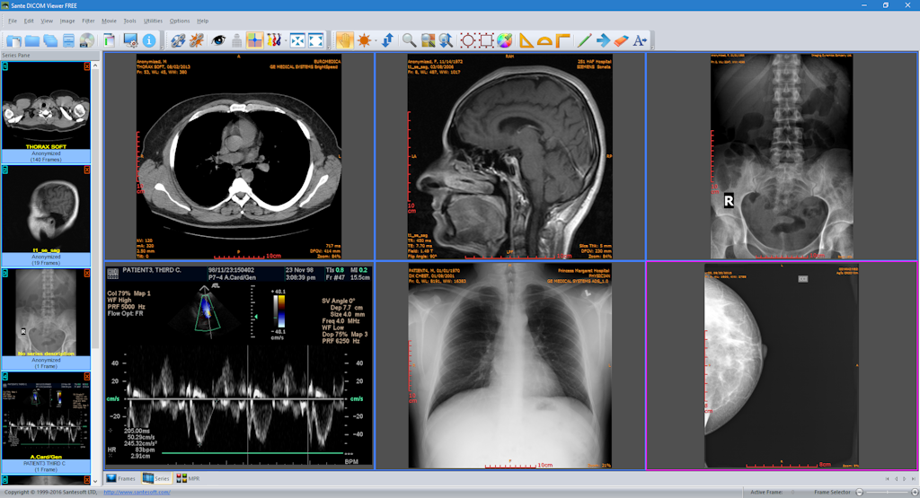 dicom viewer free download for mac