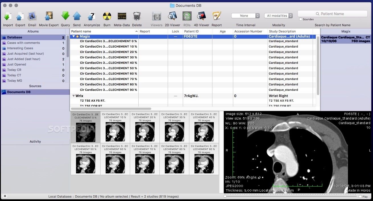 dicom viewer software for mac