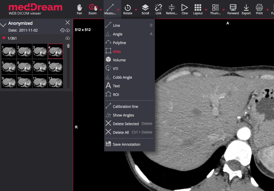 Sante DICOM Viewer Pro 12.2.5 instal the new for apple