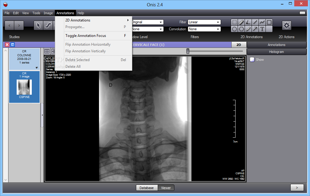 what is the best dicom viewer for windows