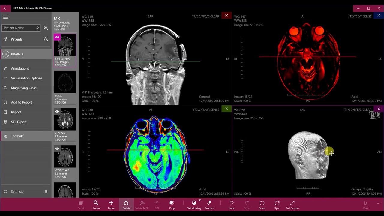 what is the best free dicom viewer for patients