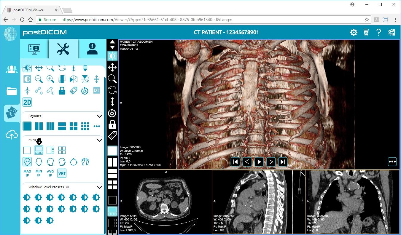 free for ios download Sante DICOM Viewer Pro 14.0.1