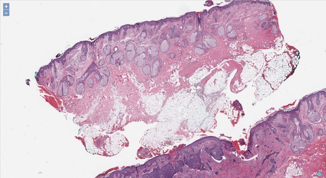 10 Open-source Whole-Slide Image Viewers and Analysis Programs; Redefining Digital Pathology