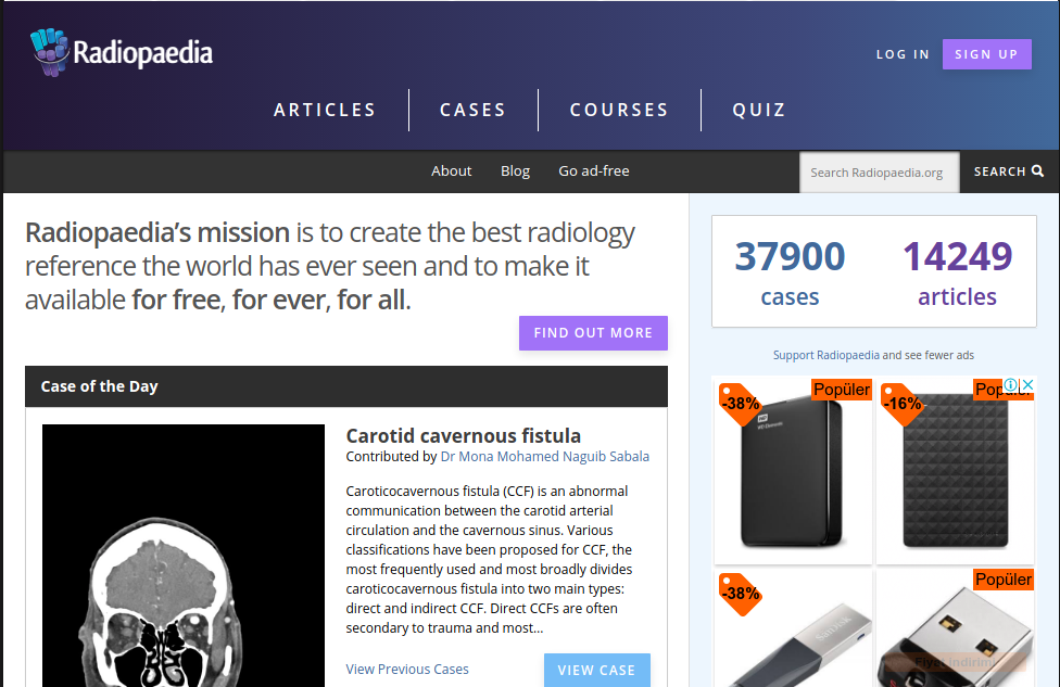 Radiopaedia.org : The top Ranked Website in Every Radiologist`s Bookmark