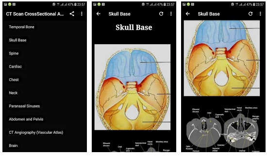 essential anatomy 4 app
