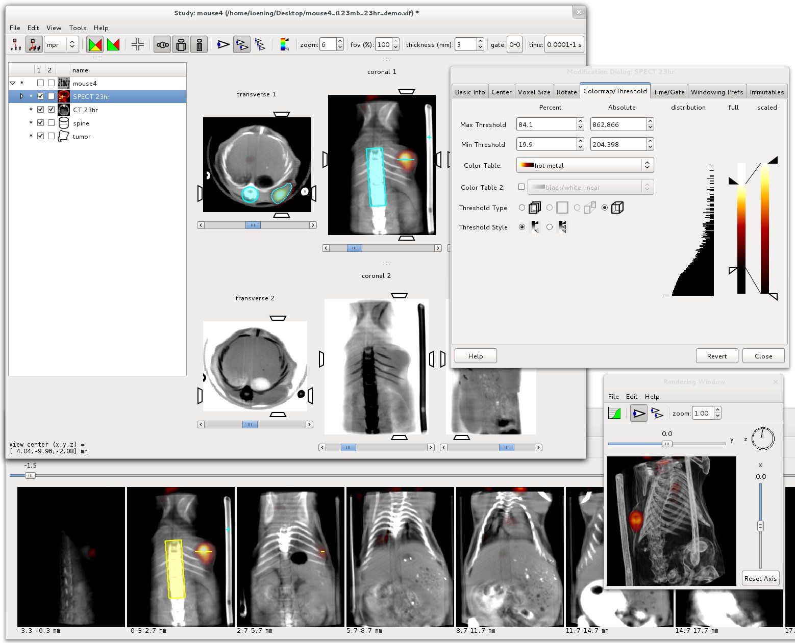 AMIDE: Open-source, free DICOM viewer for volumetric imaging