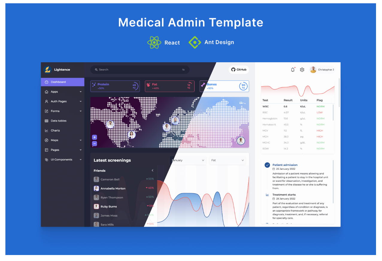 30+ Open-Source and Free Dashboard Templates