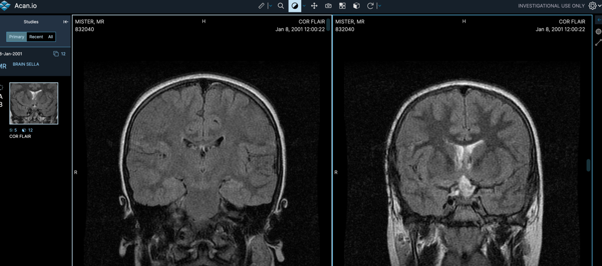 Nextcloud DICOM Viewer App