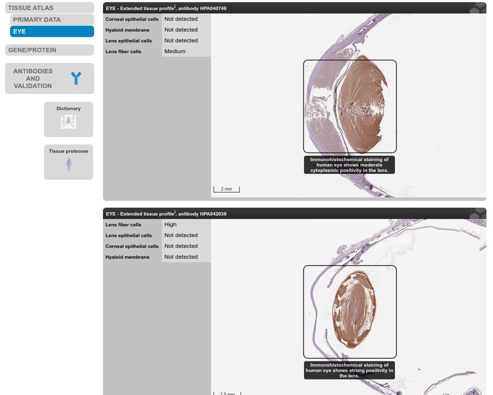 human protein atlas