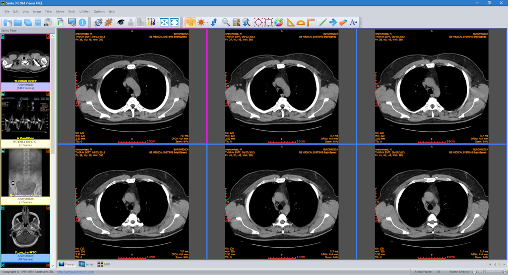 Sante DICOM Viewer: Free for Windows