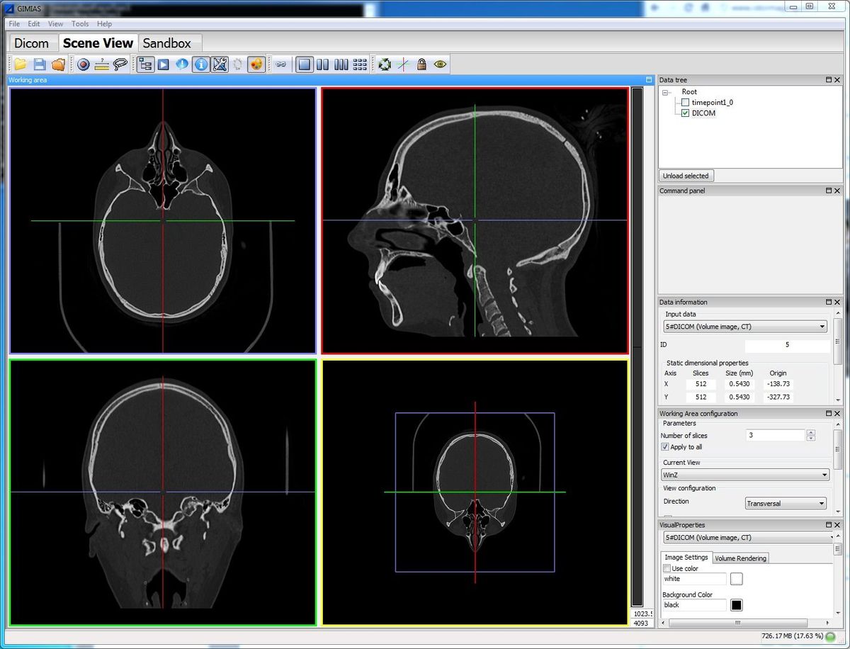 Gimias: Open source Framework for building Medical Imaging & Medical Simulation applications for Windows and Linux