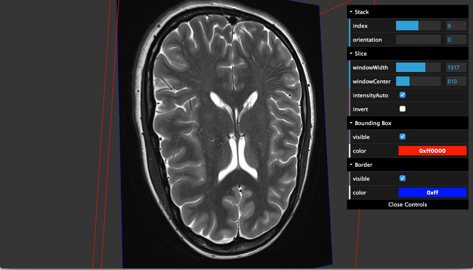 AMI Medical Imaging (AMI) JavaScript ToolKit for building Web-based 2D/ 3D DICOM apps