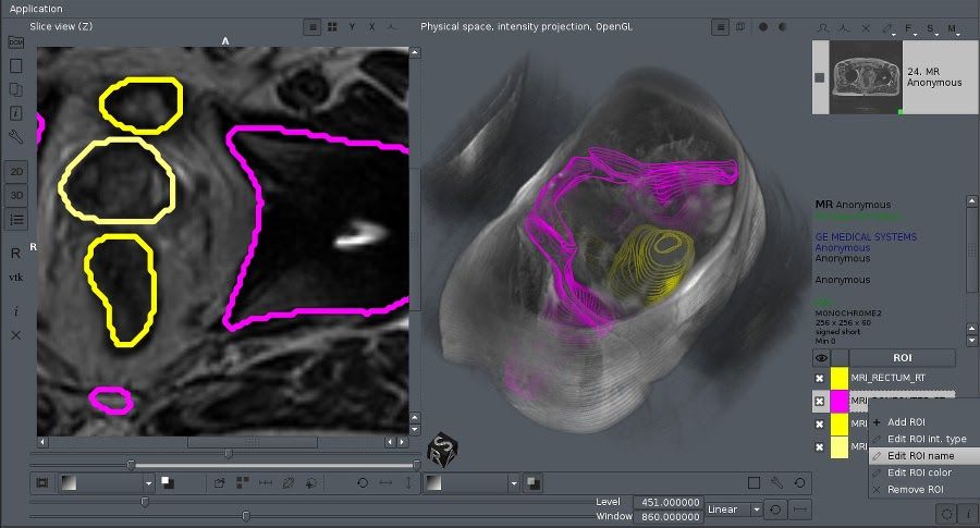 Aliza MS: is an Open Source Free DICOM Viewer for Windows, Linux, and macOS