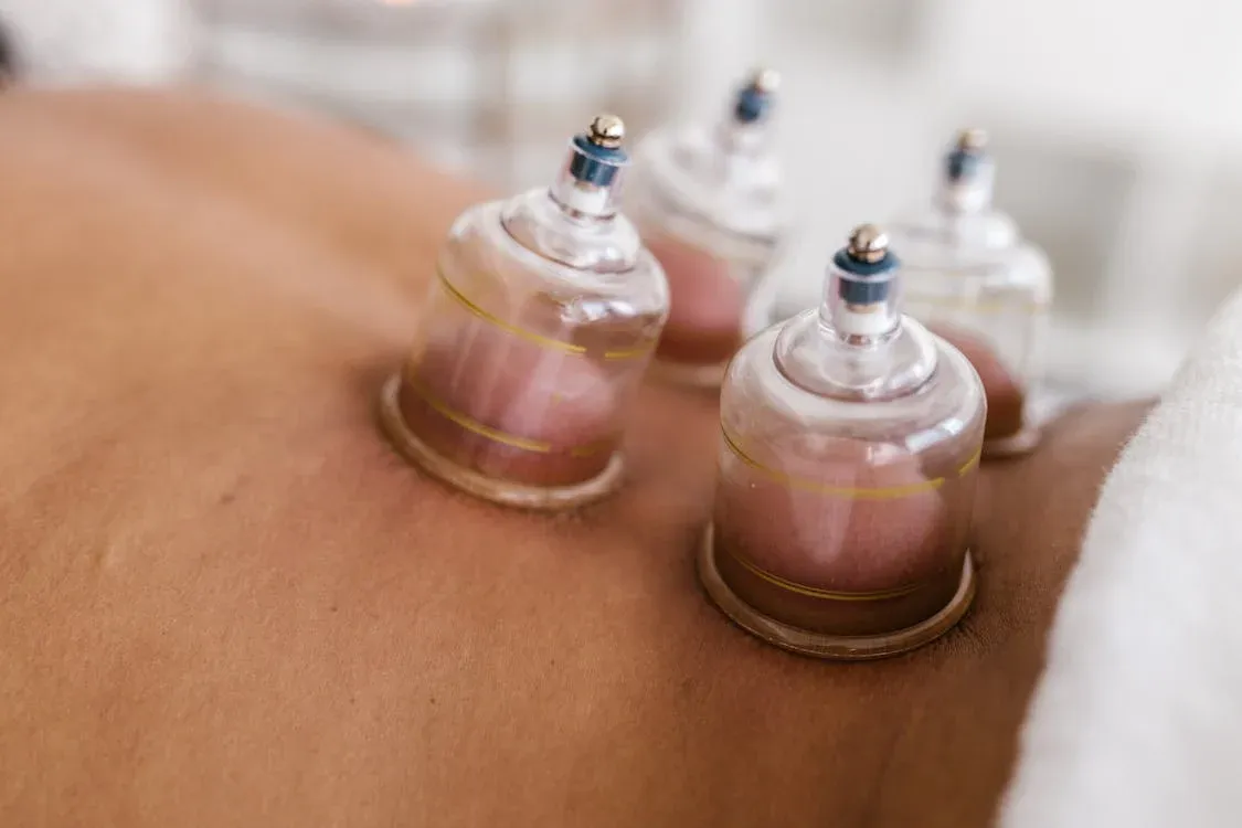 Before You Try Wet Cupping, Read This (Your Blood Might Thank You)