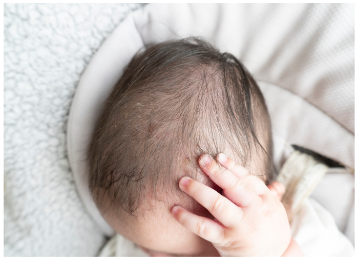 Early Signs of Periventricular Leukomalacia Parents Should Know