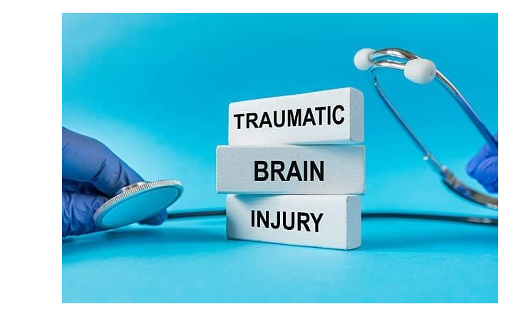 How a TBI Can Affect Your Life Long-Term