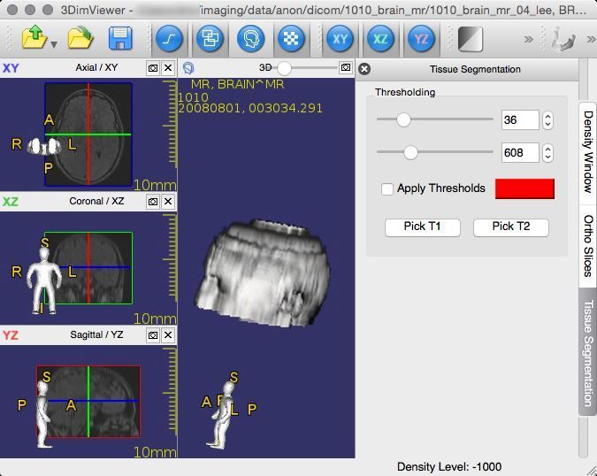 3DimViewer: open source free DICOM viewer