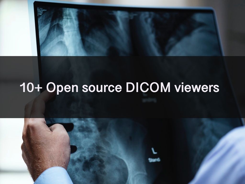Best 14  Open source & Free DICOM viewers (Linux, Mac OSX, and Windows)