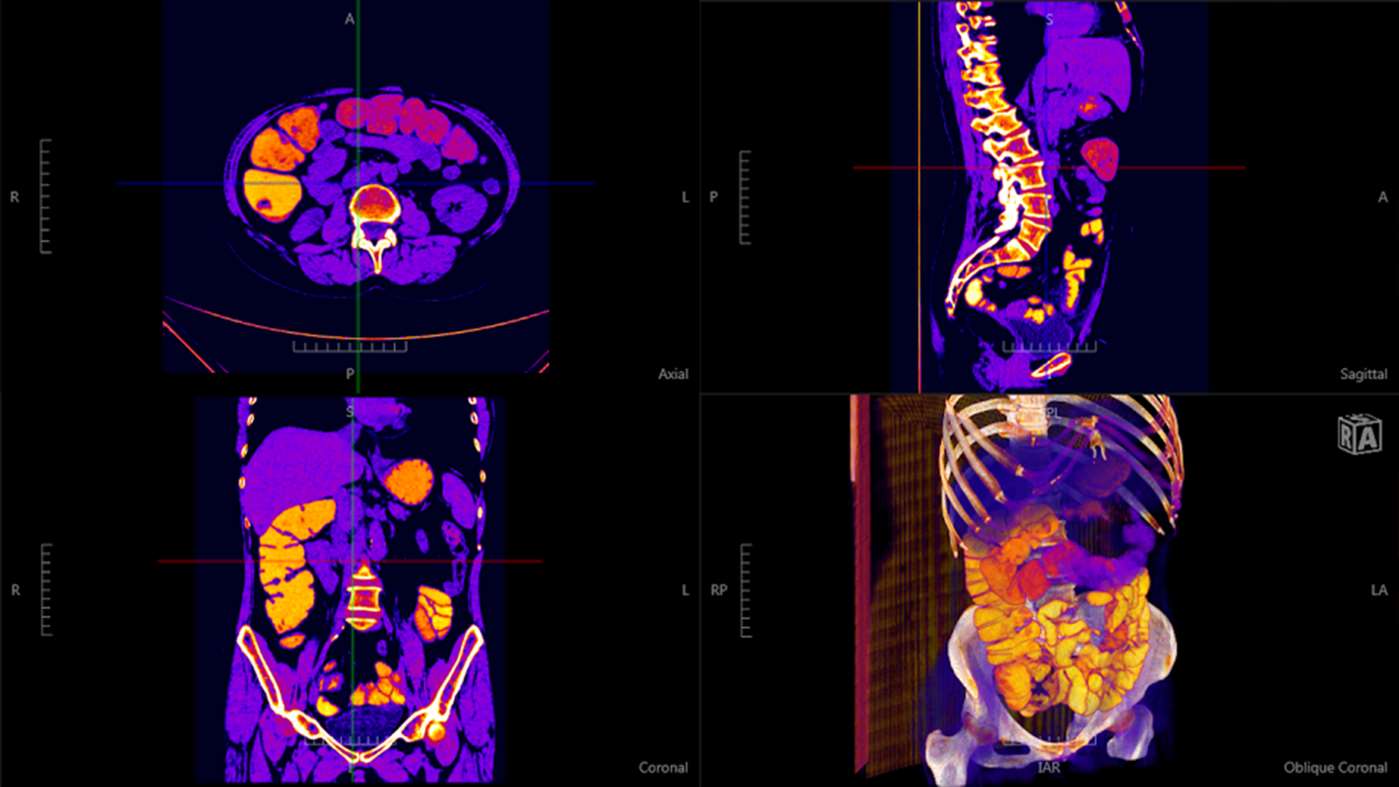 Navegatium: A Free 2D/3D DICOM Viewer with 3D Printing support for Windows