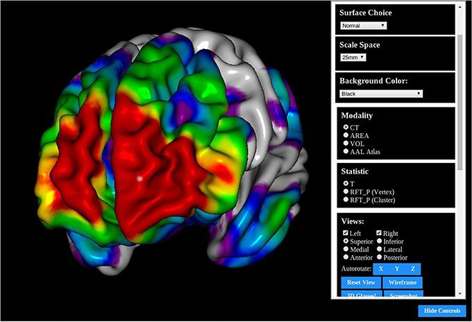 BrainBrowser: Open source Web-based Brain Visualization with Volume & Surface viewers