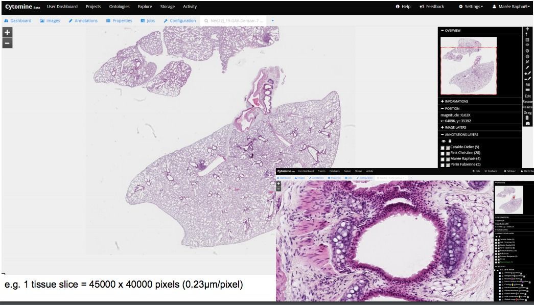 Cytomine: Free Open source Web-based Digital Pathology (WSI) solution with Machine learning flavor