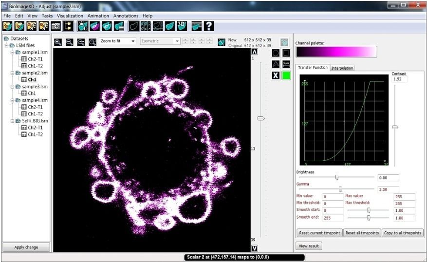 BioImageXD: Open source Microscopy Imaging Software