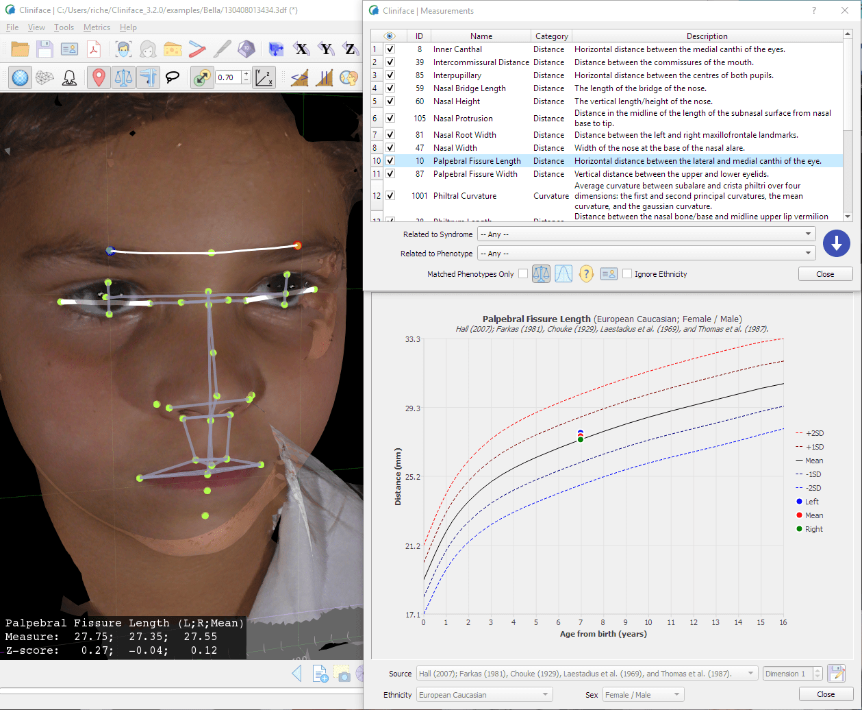 Cliniface: Open source 3D Facial Image Visualization and Analysis Software