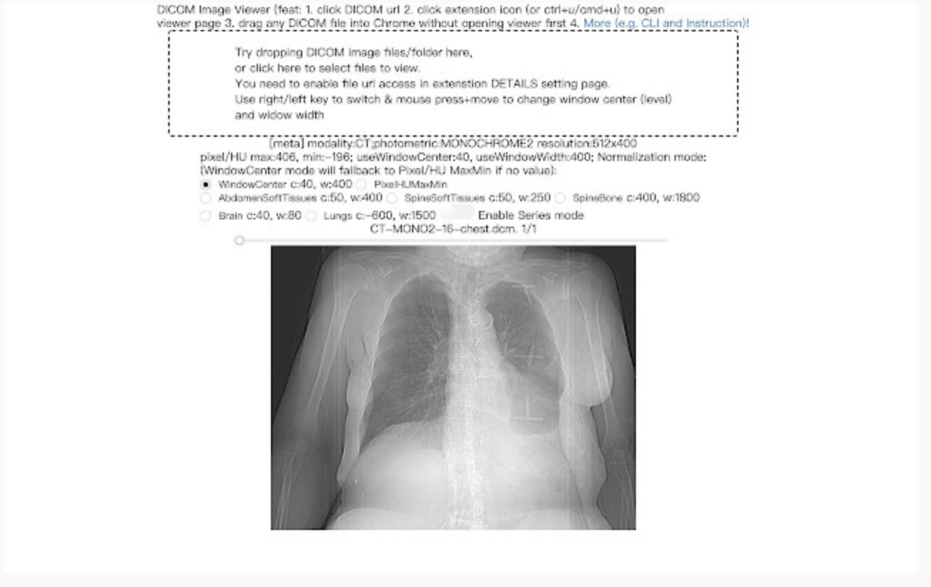 View DICOM Images on Google Chrome with DICOM Image Viewer Extension