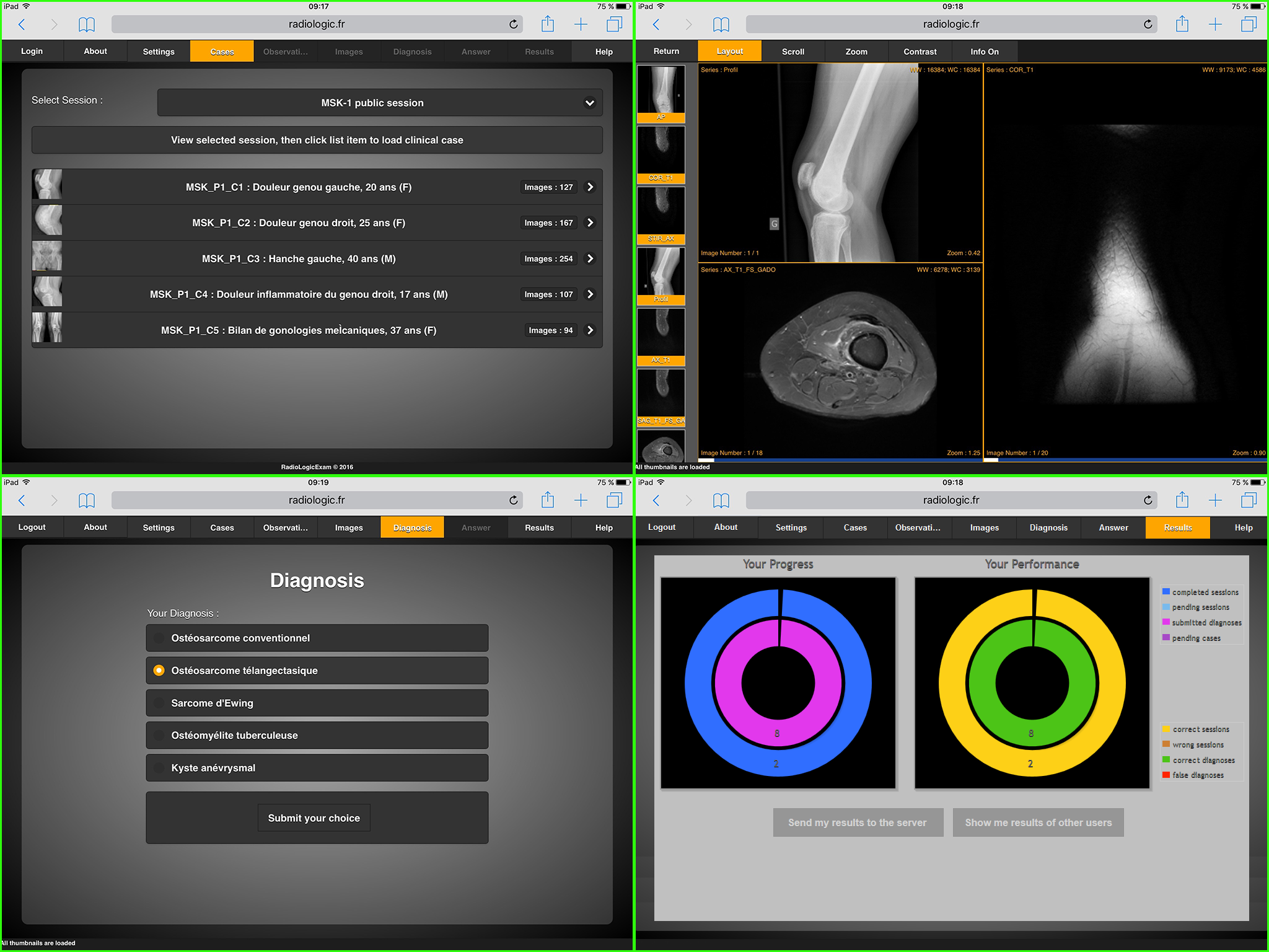RadioLogic is an Open Source Medical Imaging Learning Tool for Radiologists