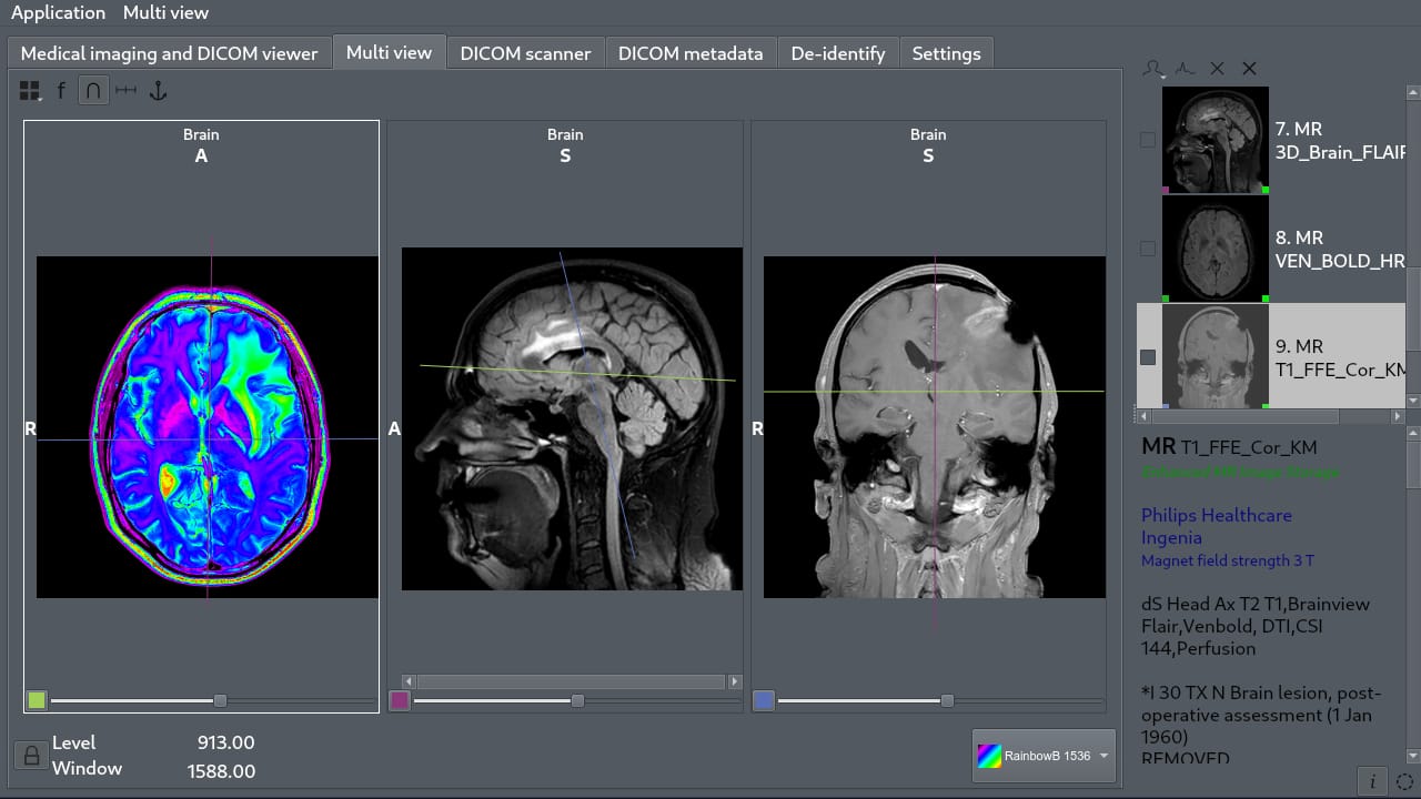 Aliza MS is a Free and Open-source DICOM Viewer for Linux and FreeBSD