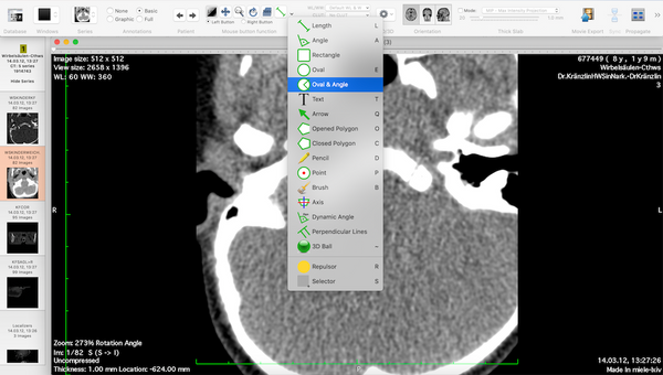 Miele-LXIV: Open source/ Free DICOM Workstation & Viewer for macOS