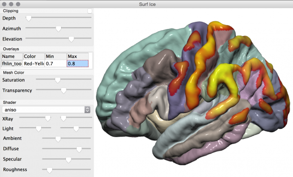 Surf Ice is an open-source brain surface renderer