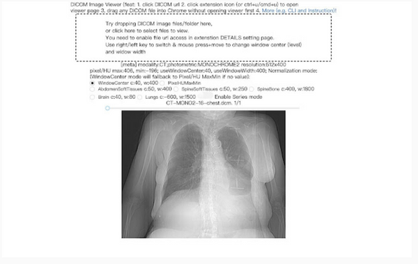 View DICOM Images on Google Chrome with DICOM Image Viewer Extension