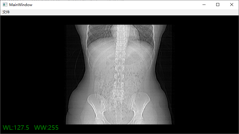 DICOM Image Viewer is a Simple Free DICOM Viewer for Windows