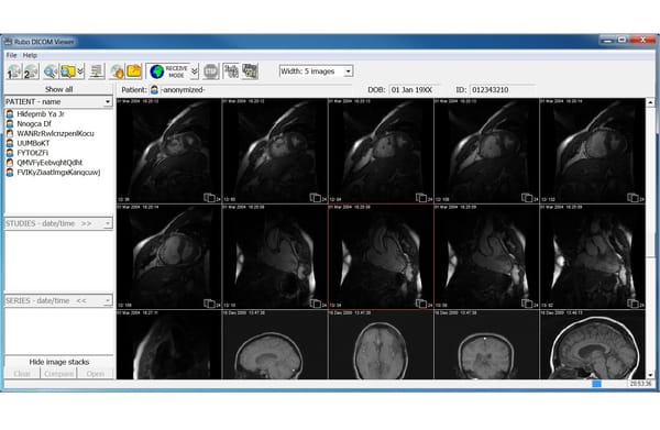 Rubo Medical Imaging is a DICOM Viewer for Windows for Radiologists and Healthcare Professionals