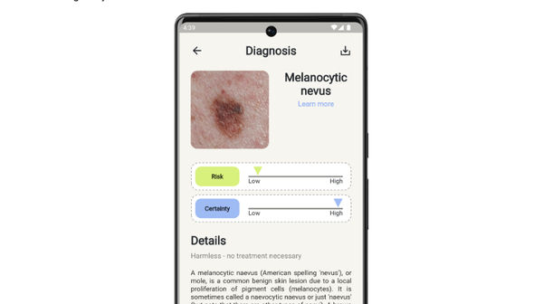 The App that can detect Skin Lesions with AI: SkinDetect