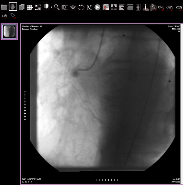 BlueLight Viewer is a Free Web-based DICOM Viewer