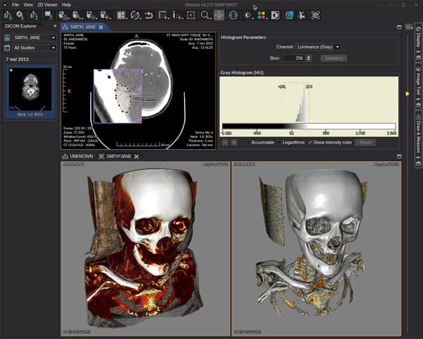 10 Free Portable DICOM Viewers To Display DICOM Images Directly from CD/ DVD and USB-Drive