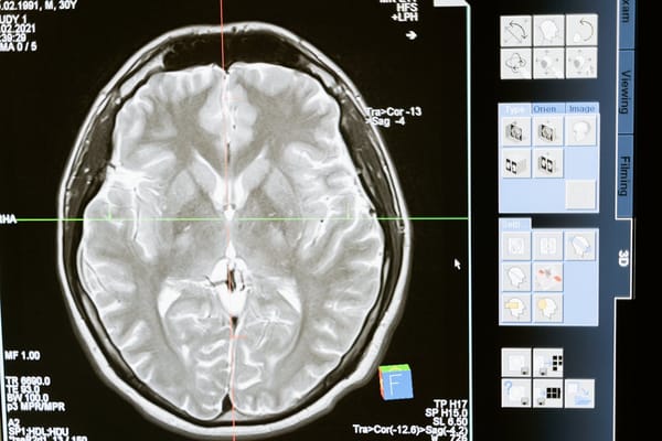 Benefits of Monochrome LCD Screens and Their Use in Medical Imaging