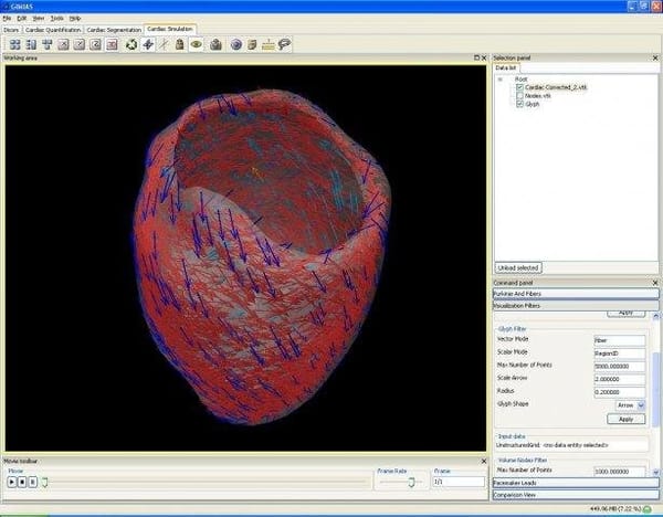 Gimias is A Free Open-source Free App for Medical Image Analysis and Simulation