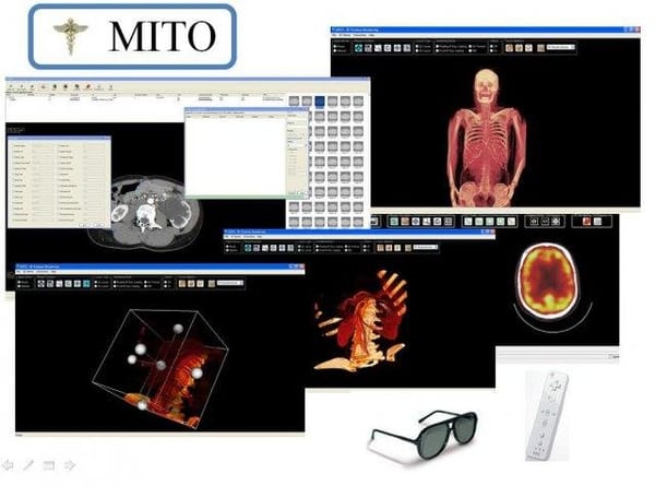 MITO is a Free and Open-source DICOM Viewer, with PACS Support