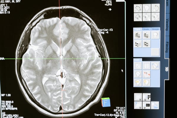 How AI is Transforming Radiology and Medical Imaging