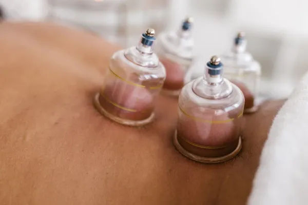 Before You Try Wet Cupping, Read This (Your Blood Might Thank You)