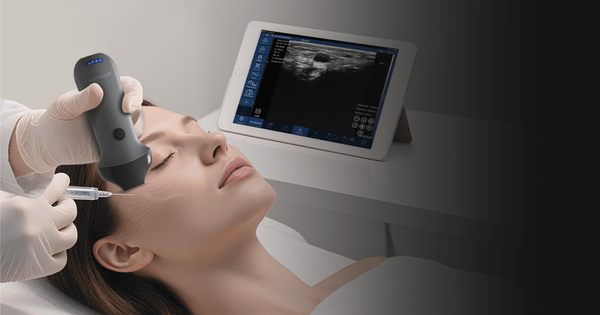 Best Portable Ultrasound for Aesthetics (2026): EagleView Review, Comparison & Budget Alternatives