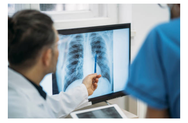 Reasons an X-Ray May Show Negative Results